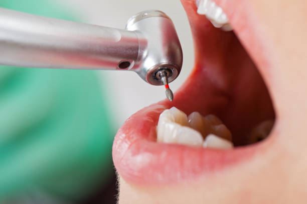 Best Cracked Tooth Emergency Dentist  in Ridge Wood Heights, FL